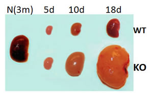 WT kidnyes-KO kidneys